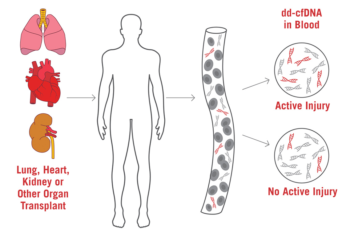 care_dx_alloseq_cfdna_scheme